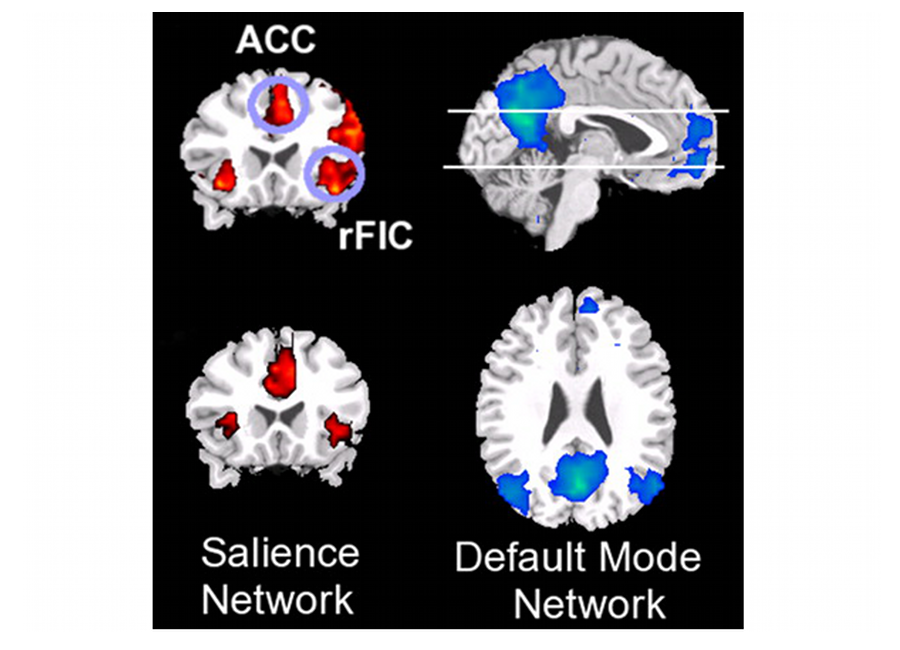 Neuroimaging